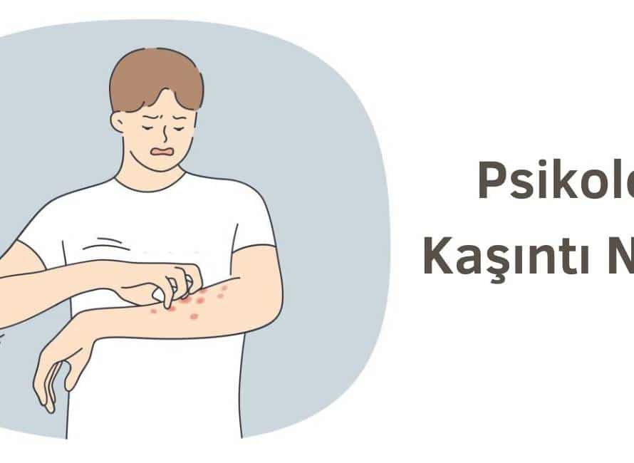 psikolojik kaşıntı nasıl geçer